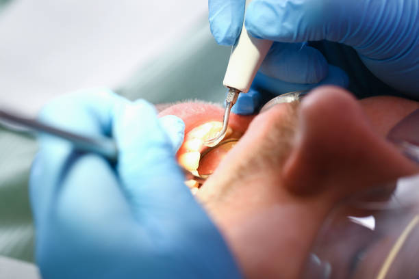 Best Walk-In Emergency Dentist in Montalvin Manor, CA