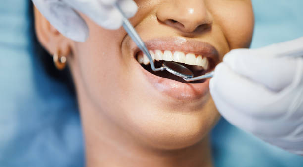 Best Weekend Emergency Dentist in Montalvin Manor, CA