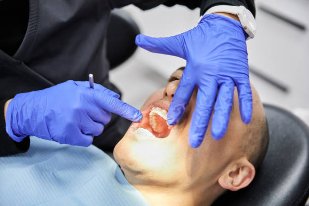 Best After-Hours Emergency Dentist in Montalvin Manor, CA